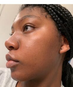 African Black Soap Paste 8 oz. 100% Raw Pure Natural From Ghana. Acne Treatment, Aids Against Eczema & Psoriasis, Dry Skin, Scars and Dark Spots. Great For Pimples, Blackhead, Face & Body Wash. Unscented 8 Ounce (Pack of 1) 46 61jQtgVpzlL