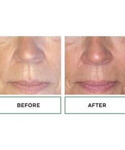 Replenix Age Restore Nighttime Therapy Face Cream, Anti-Aging Medical-Grade Facial Moisturizer for Mature & Dry Skin Full Size 12 61jbDH4oGL