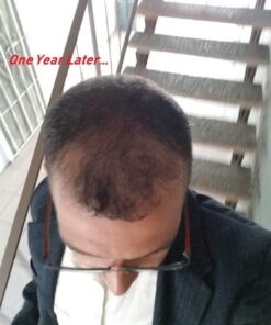 Volumizing Biotin Shampoo for Thinning Hair - Thin Hair Shampoo with Rosemary Argan and Essential Oils for Hair Care - Vegan Sulfate Free Shampoo for Damaged Dry Hair Paraben and Cruelty Free Sandalwood 16 Fl Oz (Pack of 1) 41 61k60t2MpEL