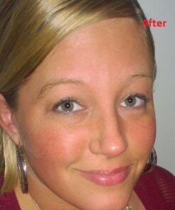 InstaNatural BHA Exfoliating Face Serum, Minimizes Lines, Wrinkles, and Blemishes, with Vitamin C and Salicylic Acid, 1 Fl Oz 38 61kmq567lEL