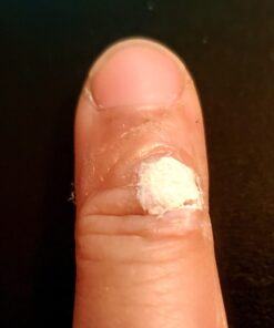 Compound W Maximum Strength Fast Acting Gel Wart Remover, 0.25 oz, 2 Pack unflavored 0.5 Ounce (Pack of 1) 39 61ksRmPRGjL