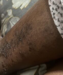 Organic Aloe Vera Gel - 100% Pure for Skin, Sunburn Relief & Face Moisturizer - Extracted from Aloe Vera Plant with Manuka Honey, Orchid & Apple Stem Cells - Everyday Use - 8 Fl Oz 8 Fl Oz (Pack of 1) 37 61lIpfy5eBL