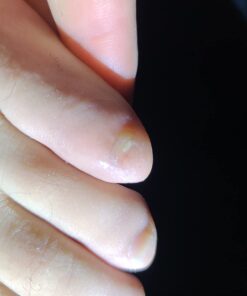 Fungi Nail Anti-Fungal Ointment, Kills Fungus That Can Lead to Nail & Athlete’s Foot with Tolnaftate & Clinically Proven to Cure Infections, Natural Color, 0.7 Fl Oz 38 61lL OS7UzL