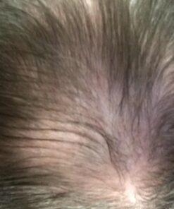 Nutrafol Men's Hair Growth Supplements, Clinically Tested for Visibly Thicker Hair and Scalp Coverage, Dermatologist Recommended - 1 Month Supply 53 61m1wdcKdWL