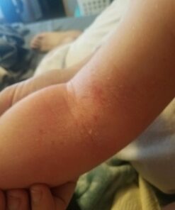 Hydrating Face Moisturizer & Body Cream with Manuka Honey Cream - Organic Face Moisturizer & Body Lotion for Extremely Dry Skin - For Dry & Itchy Skin, Rosacea & Eczema Prone Skin (Original, 2oz) Original 2 Ounce (Pack of 1) 42 61mCJ9q1iL