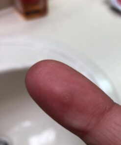 Compound W Nitrofreeze | Wart Removal | 1 Pen & 5 Replaceable Tips 43 61mZ85iK6QL 2