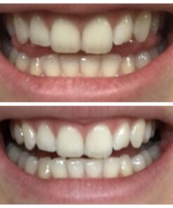 Zen Charcoal Hardwood Activated Charcoal Powder, 100% USA Trees, 8 oz 8 Ounce (Pack of 1) 34 61moCAcM80L