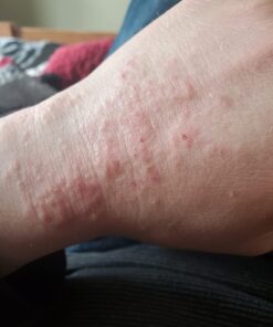 Eucerin Eczema Relief Cream, Full Body Lotion for Eczema-Prone Skin, Moisturizing Eczema Cream, Body Moisturizer, 8 oz. Tube 51 61nTSW1lJZL