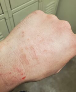 Eucerin Eczema Relief Cream, Full Body Lotion for Eczema-Prone Skin, Moisturizing Eczema Cream, Body Moisturizer, 8 oz. Tube 52 61nyt5987FL