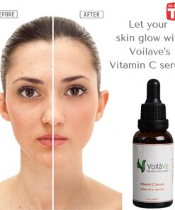 VoilaVe Vitamin C Serum For Face with Hyaluronic Acid | Brightening & Hydrating Serum | Remove Fine Lines Wrinkles & Anti-Aging Serum | Helps to Rebuild Collagen | Airless Pump | As Seen On TV- 1 Oz 29 61oFrDXfR3L