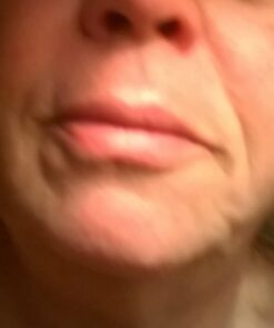 Baebody Critically Acclaimed Retinol Topical Facial Serum with Vitamin E, Hyaluronic Acid, Jojoba Oil, 1 Oz Retinol Serum 15 61pZLJJr2uL