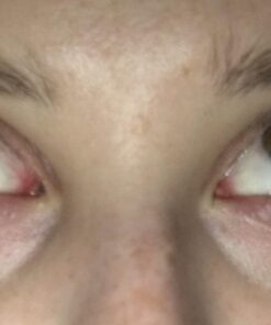 Deluxe Collagen Eye Mask Collagen Pads For Women By Purederm 2 Pack Of 30 Sheets/Natural Eye Patches With Anti-aging and Wrinkle Care Properties/Help Reduce Dark Circles and Puffiness 39 61q3P rBpmL