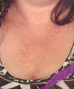 Aidance Skincare & Topical Solutions terrasil Anti-fungal Treatment MAX - 50g 26 61qREHb8G9L