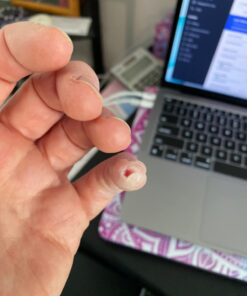 Active Skin Repair Hydrogel - Natural & Non-Toxic First Aid Ointment & Antiseptic Gel for Minor Cuts, Wounds, Scrapes, Rashes, Sunburns, and Other Skin Irritations (Single, 3 oz Gel) 3 Fl Oz (Pack of 1) 38 61qY0BPecxL