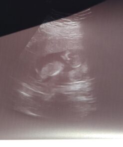 (2 Month Supply) Cassava Root - Fertility Supplement for Twins - Vitamin for a Natural Pregnancy 22 61s0Q3px41L