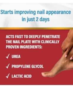 Kerasal Nail Renewal, Restores Appearance of Discolored or Damaged Nails, 0.33 fl oz (Packaging May Vary) 26 61sAlibT0jL