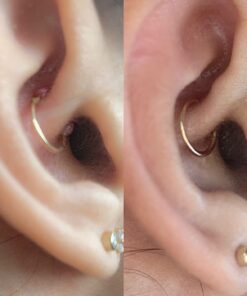 BRIOTECH Hypochlorous Acid Spray, Topical Skin Face & Body Mist, Support Irritations, Soothe Redness, Dry Skin & Scalp, Athletic Itch, Packaging May Vary 3.4 Fl Oz (Pack of 1) 42 61sBg50GGWL