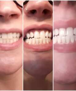 Dental Duty Sensitive Teeth Whitening Strips – Professional Vegan Stain Remover White Strips for Sensitive Teeth for Coffee & Tea Stains – Get A Lighter Shade After One Application – 28 Strips 48 61sFQWe6agL