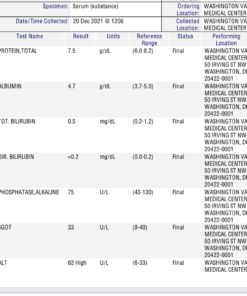 Arazo Nutrition Liver Cleanse Detox & Repair Formula – Milk Thistle Herbal Support Supplement: Silymarin, Beet, Artichoke, Dandelion, Chicory Root 32 61sQH4GP ML