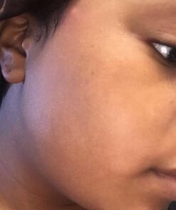 African Black Soap Paste 8 oz. 100% Raw Pure Natural From Ghana. Acne Treatment, Aids Against Eczema & Psoriasis, Dry Skin, Scars and Dark Spots. Great For Pimples, Blackhead, Face & Body Wash. Unscented 8 Ounce (Pack of 1) 55 61tRvJYRvbL