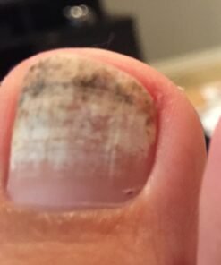 3 in 1 Professional Foot Spa Kit-with Tea Tree Foot & Body Soak-Tea Tree Body Wash & Nail Blend-Soothes Dry, Burning & Itchy Skin-Refreshes Unwanted Foot Odor-Restores Unhealthy Nails-Purely Northwest Tea Tree Oil 3 Piece Set 38 61tvZJcpf3L 1