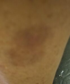 Structured Colloidal Silver Gel for Burns and Wounds - Cooling Silver Extra Strength 35ppm Silver Gel 30 61uDt1WE2NL