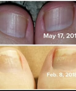 3 in 1 Professional Foot Spa Kit-with Tea Tree Foot & Body Soak-Tea Tree Body Wash & Nail Blend-Soothes Dry, Burning & Itchy Skin-Refreshes Unwanted Foot Odor-Restores Unhealthy Nails-Purely Northwest Tea Tree Oil 3 Piece Set 36 61uJdQ1wgyL 1