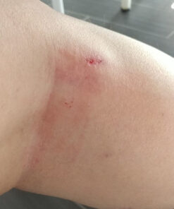 IPOW 2 Pack Knee Pain Relief & Patella Stabilizer Knee Strap Brace Support for Hiking, Soccer, Basketball, Running, Jumpers Knee, Tennis, Volleyball & Squats. One Size Black 32 61uSjVCYIkL