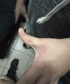 Aidance Skincare & Topical Solutions terrasil Anti-fungal Treatment MAX - 50g 36 61uXl0MhmhL