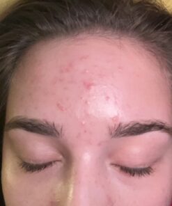 DIM Supplement 200 mg | Estrogen Hormone Balance for Women & Men | Hormonal Acne Supplements, Menopause Support, Antioxidant Support | Clean Label Project Certified, Vegan, Soy Free | 60 Ct. DIM 200mg 63 61ucuTrlgvL