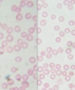 AmScope B120C-E1 40X-2500X LED Biological Binocular Compound Microscope with 3D Double Layer Mechanical Stage + 1.0 MP USB Digital Camera Imager 1.0 MP Camera 31 61udzmwwxxL