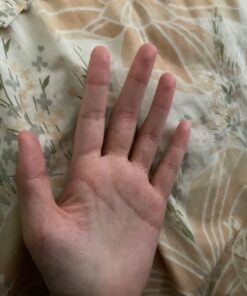 SkinSmart Antimicrobial Eczema Therapy with Hypochlorous Acid, Removes Bacteria so Skin Can Heal, for Adults, Kids and Seniors, 8 Ounce Clear Spray 8 Fl Oz (Pack of 1) 46 61ue9T6OVsL