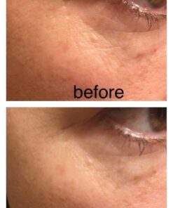 SkinMedica HA5 Rejuvenating Hydrator Hyaluronic Acid Serum for Face with Five Types of Hyaluronic Acid that Smooth Fine Lines and Wrinkles, For All Skin Types, 2 Oz 2 Ounce (Pack of 1) 23 61v1W2BhwTL