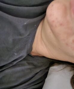 DIM Supplement 200 mg | Estrogen Hormone Balance for Women & Men | Hormonal Acne Supplements, Menopause Support, Antioxidant Support | Clean Label Project Certified, Vegan, Soy Free | 60 Ct. DIM 200mg 52 61v3lxKvCnL