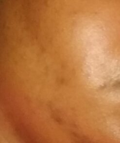 African Black Soap Paste 8 oz. 100% Raw Pure Natural From Ghana. Acne Treatment, Aids Against Eczema & Psoriasis, Dry Skin, Scars and Dark Spots. Great For Pimples, Blackhead, Face & Body Wash. Unscented 8 Ounce (Pack of 1) 65 61v5q24F9L