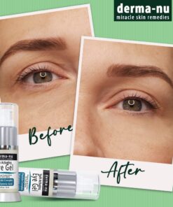 Eye Gel Anti-Aging Cream - Treatment for Dark Circles, Puffiness, Wrinkles and Fine Lines - Hyaluronic Acid Formula Infused Serum with Aloe Vera & Jojoba for Ageless Smooth Skin 5 oz 0.5 Fl Oz (Pack of 1) 23 61vH6iPWLrL