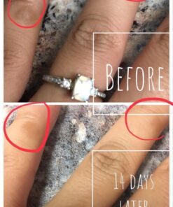 Cammile Q Organic Tamanu Oil - Natural Psoriasis Treatment - Great For Eczema, Acne & Scars - Cold Pressed 51 61w6cIJjPgL