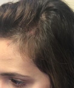 Saw Palmetto & Cayenne Scalp Oil For Hair Growth, Hair Loss Serum, Hair Oil For Dry Damaged Hair And Growth, Hair Growth Serum For Thicker Longer Fuller Healthier Hair, All Natural Vitamin Rich 36 61wv23vYmmL