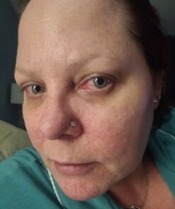 Hyaluronic Acid Serum for Skin 100% Pure Anti Aging Serum Intense Hydration Moisture Non greasy Paraben free, Wrinkle Reducing and Brightening Serum (Pro Formula) 2oz 2 Fl Oz (Pack of 1) 50 61x0h9PkjQL