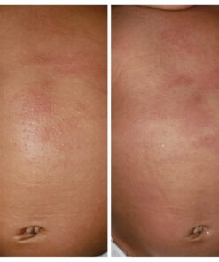 Burt's Bees Baby Diaper Balm, Multipurpose Healing Ointment Softens & Calms Dry Skin, Eczema Safe, with Shea Butter, Plant Based Formula, Pediatrician Tested, 7.5 Oz 7.5 Ounce (Pack of 1) 65 61xdDYYMA8L 1