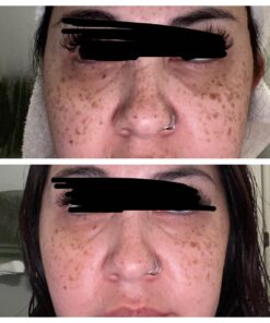 RoC Retinol Correxion Under Eye Cream for Dark Circles & Puffiness, Daily Wrinkle Cream, Anti Aging Line Smoothing Skin Care Treatment 0.5 oz (Packaging May Vary) 0.5 Fl Oz (Pack of 1) 33 61xl1I4Bo0L