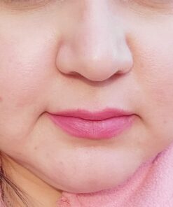 NeedCrystals Microdermabrasion Crystals 8 oz. / 227g. DIY Face Scrub. Natural Facial Exfoliator for Dull or Dry Skin Improves Scars, Blackheads, Pore Size, Wrinkles, Blemishes & Skin Texture 8 Ounce (Pack of 1) 8 oz Microdermabrasion Crystals 42 61yIut7jsZL 1