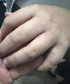 Aidance Skincare & Topical Solutions terrasil Anti-fungal Treatment MAX - 50g 37 61yitRjjzrL