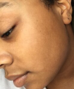 African Black Soap Paste 8 oz. 100% Raw Pure Natural From Ghana. Acne Treatment, Aids Against Eczema & Psoriasis, Dry Skin, Scars and Dark Spots. Great For Pimples, Blackhead, Face & Body Wash. Unscented 8 Ounce (Pack of 1) 56 61yrs5z9YiL