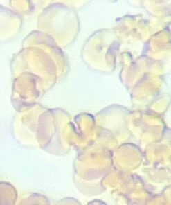 SWIFT SW350T 40X-2500X Magnification, Siedentopf Head, Research-Grade Trinocular Compound Lab Microscope with Wide-Field 10X and 25X Eyepieces, Mechanical Stage, Abbe Condenser, Camera-Compatible 36 61zOnEgCQ6L