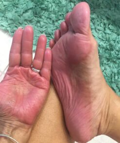 Manuka Honey Cream Moisturizer for Dry Skin - Eczema Honey Cream Face Moisturizer for Sensitive Skin - Soothing & Redness Relief Face Cream for Dry Skin - Face, Hand & Body Moisturizer for Women & Men 4 Ounce (Pack of 1) 26 71 8p0dDWcL