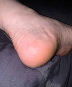 Kerasal Intensive Foot Repair, Skin Healing Ointment for Cracked Heels and Dry Feet, 1 Oz 37 71 9Qu73NUL