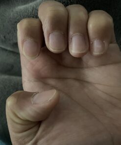 Nutra Nail 5 to 7 Day Growth Treatment - Fast Keratin Nail Hardener & Nail Strengthener for Thin Nails, Brittle & Damaged (0.47 Fl Oz) 0.50 Fl Oz (Pack of 1) 39 71 9x9BgRYL 2