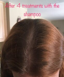 Ultrax Labs Hair Growth Shampoo for Thinning Hair and Hair Loss, Hair Thickening Shampoo, Hair Growth for Women and Men - Hair Surge 8 oz 8 Fl Oz (Pack of 1) - Shampoo 46 71 CLHzV6rL