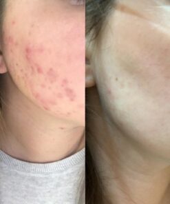 Zhou Nutrition Saw Palmetto Extract 500 mg, Prostate Health, Urinary Tract Support, DHT Blocker for Men and Women Hair Growth, Non-GMO, 100 Capsules (Packaging may vary) 23 71 JDbrHhL